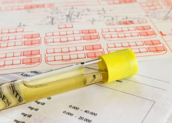 Urine sample in a sealed container placed on diagnostic lab forms for medical testing.