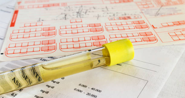 Urine sample in a sealed container placed on diagnostic lab forms for medical testing.