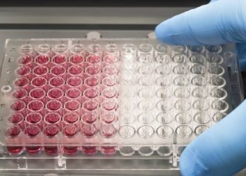 Gloved hand holding ELISA test plate for viral diagnostic screening