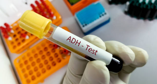 ADH test tube held in gloved hand