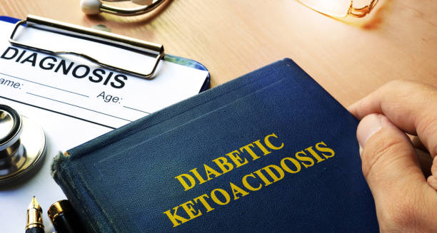 Book with diabetic ketoacidosis title beside medical diagnosis clipboard