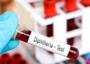Blood sample labelled diphtheria test held by gloved hand in laboratory