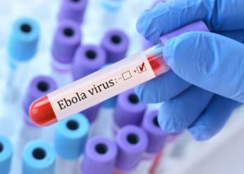 Positive Ebola virus test result in a blood sample held by gloved hand.