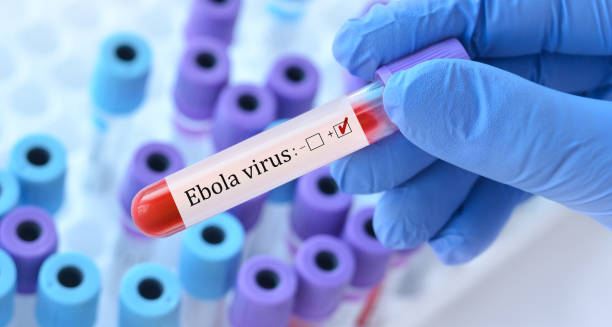 Positive Ebola virus test result in a blood sample held by gloved hand.