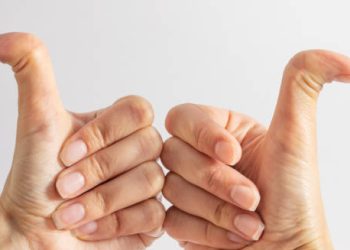 Diagnosis of Ehlers-Danlos Syndromes