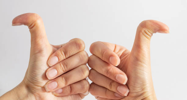 Diagnosis of Ehlers-Danlos Syndromes