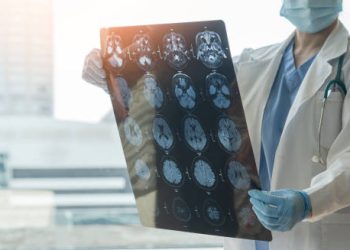 Doctor examining brain scans for signs of encephalitis.