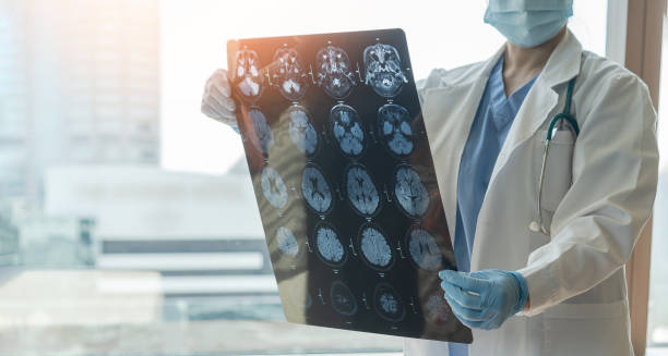 Doctor examining brain scans for signs of encephalitis.