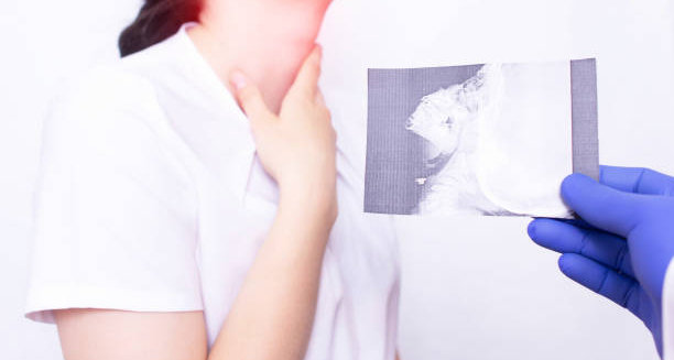 Doctor examining throat X-ray of a woman with epiglottitis symptoms