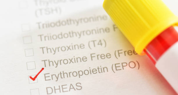 Erythropoietin blood test form with sample tube used to diagnose erythrocytosis