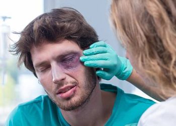 Medical professional examining bruised eye of an injured man