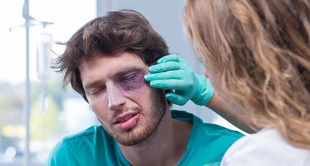 Medical professional examining bruised eye of an injured man