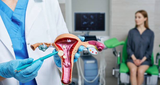 Gynaecologist explaining fibroid diagnosis with anatomical uterus model