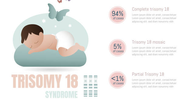 Illustration explaining Edwards’ Syndrome with baby and trisomy 18 chromosome breakdown.