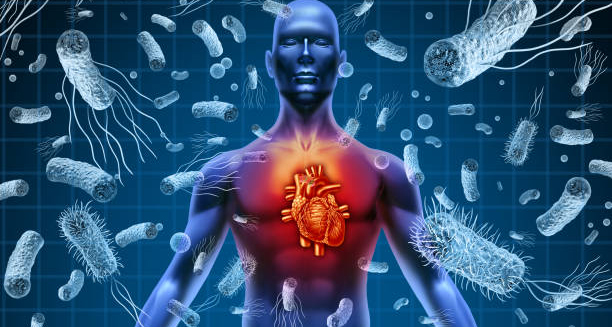 Digital illustration of endocarditis affecting the human heart with surrounding bacteria.