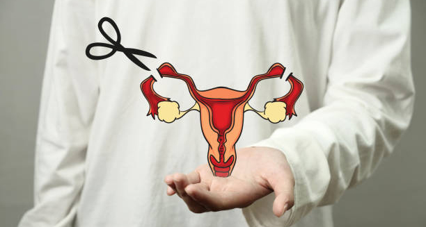 Illustration of female reproductive system with scissors symbolising genital mutilation