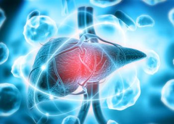 Enlarged liver due to chronic myeloid leukaemia (CML) – a common symptom caused by excess white blood cell production.