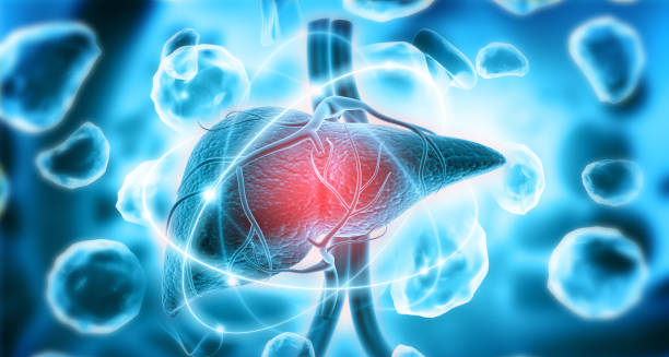 Enlarged liver due to chronic myeloid leukaemia (CML) – a common symptom caused by excess white blood cell production.