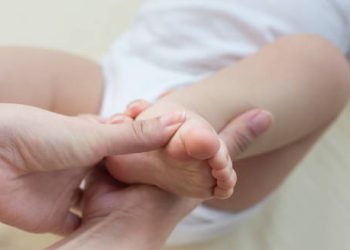 Close-up of a newborn’s foot showing signs of club foot deformity