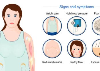 Illustration showing a woman with common symptoms of Cushing’s Syndrome, including weight gain and stretch marks.
