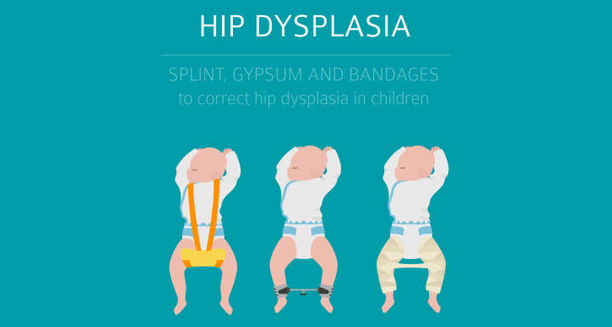 Illustration of infants with hip dysplasia braces