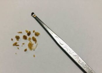 Removed chunks of earwax next to a metal ear pick