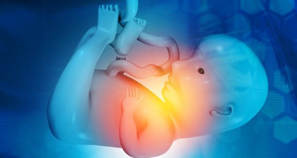 Symptoms of Edwards’ Syndrome