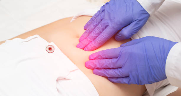Doctor examining abdomen for fibroid treatment