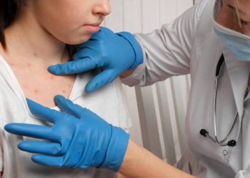 Doctor examining chickenpox rash on young girl’s chest