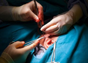 Surgeon performing cholesteatoma removal surgery on a patient’s ear