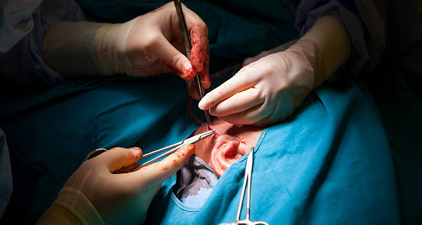 Surgeon performing cholesteatoma removal surgery on a patient’s ear