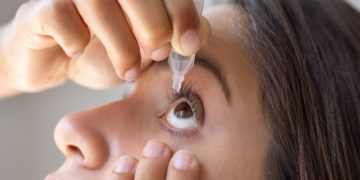Woman applying eye drops for conjunctivitis treatment