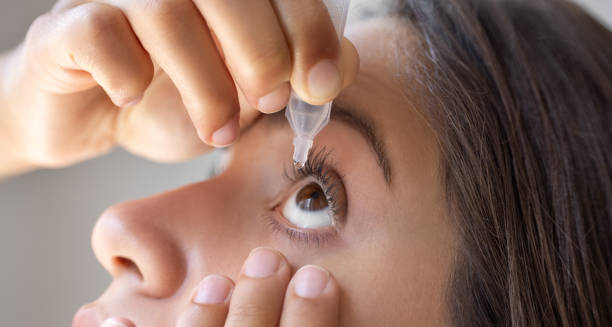 Woman applying eye drops for conjunctivitis treatment