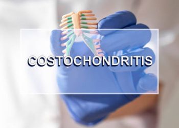 Medical professional wearing gloves holding a model of the rib cage with the word “Costochondritis” overlayed.