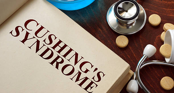 Notebook with the title “Cushing’s Syndrome” next to a stethoscope and tablets, symbolising medical treatment.