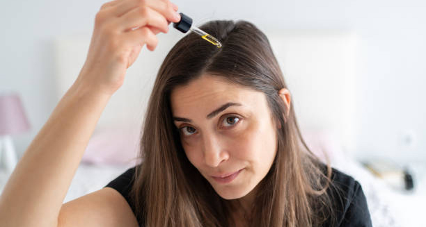 Woman applying hair serum with dropper to treat dandruff