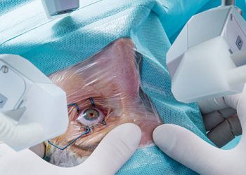 Retinal detachment eye surgery