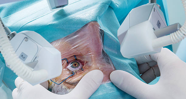 Retinal detachment eye surgery