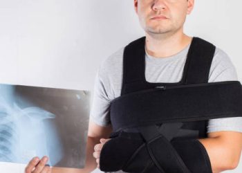 Man in shoulder brace holding X-ray after treatment for dislocated shoulder