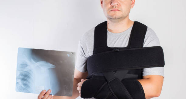 Man in shoulder brace holding X-ray after treatment for dislocated shoulder