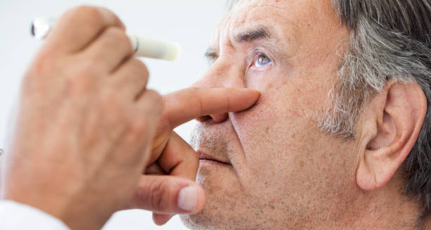 Treatment of Ectropion