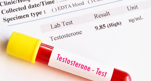 Treatment of Ejaculation Problems