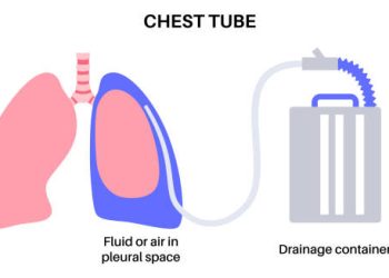 Treatment of Empyema