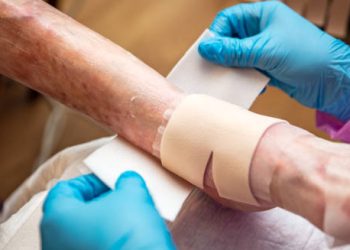 Medical professional applying bandages to fragile skin affected by Epidermolysis Bullosa