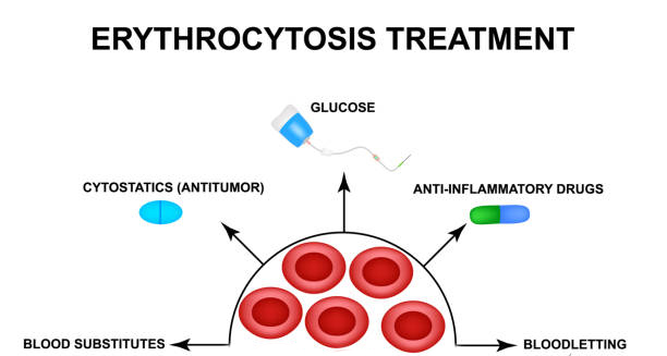 Diagram showing treatment options for erythrocytosis including bloodletting and medication