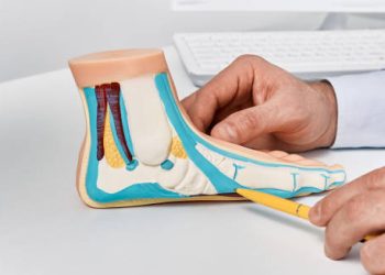 Doctor pointing at anatomical foot model showing flat feet causes