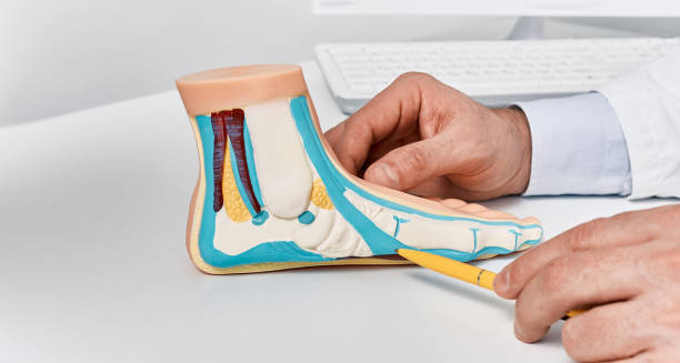 Doctor pointing at anatomical foot model showing flat feet causes