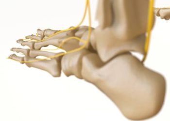 Anatomical illustration showing nerve and bone structures in the foot related to foot drop