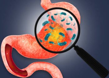 Bacterial infection in the stomach causing gastritis