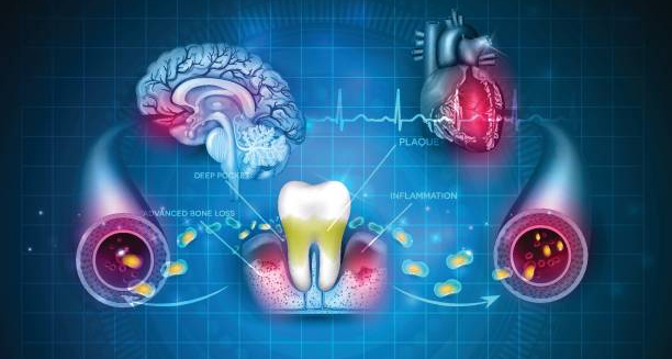 Illustration linking gum disease to brain, heart, and blood vessel health issues